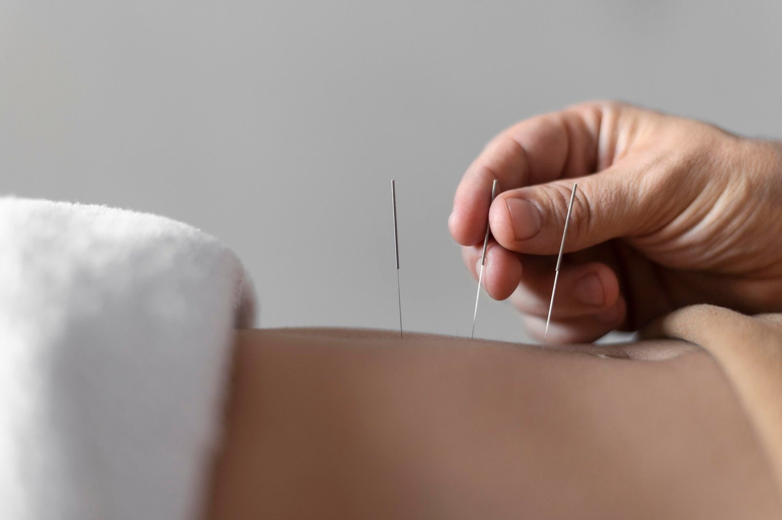 physiotherapy and wellness, dry needling therapy