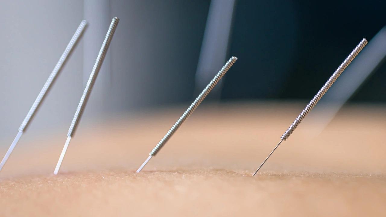 Dry Needling