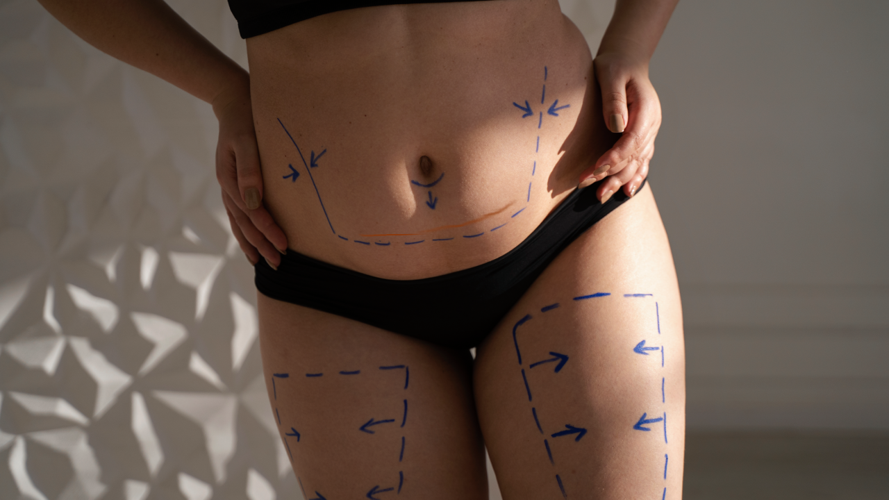 Cosmetic Surgery Recovery