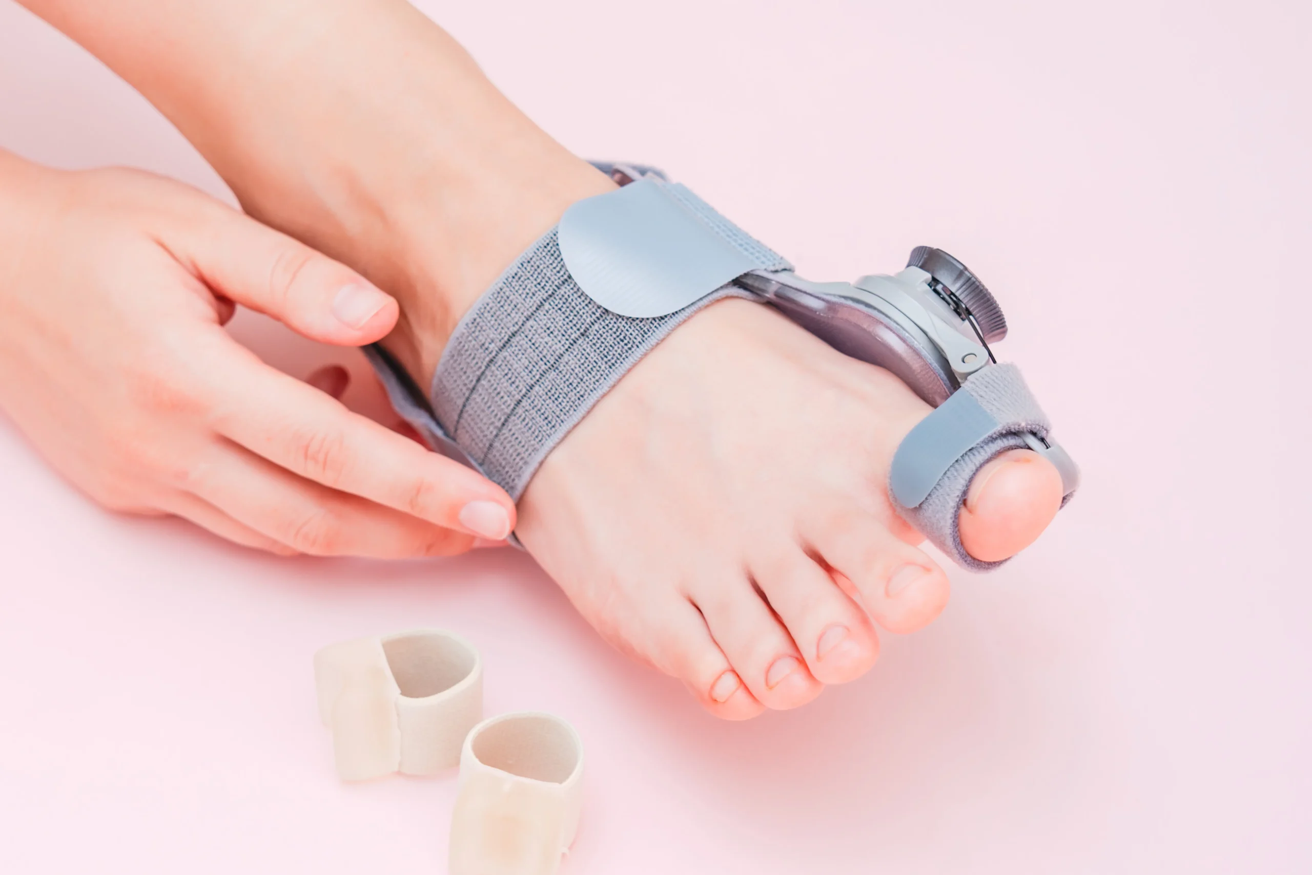 Hallux Valgus